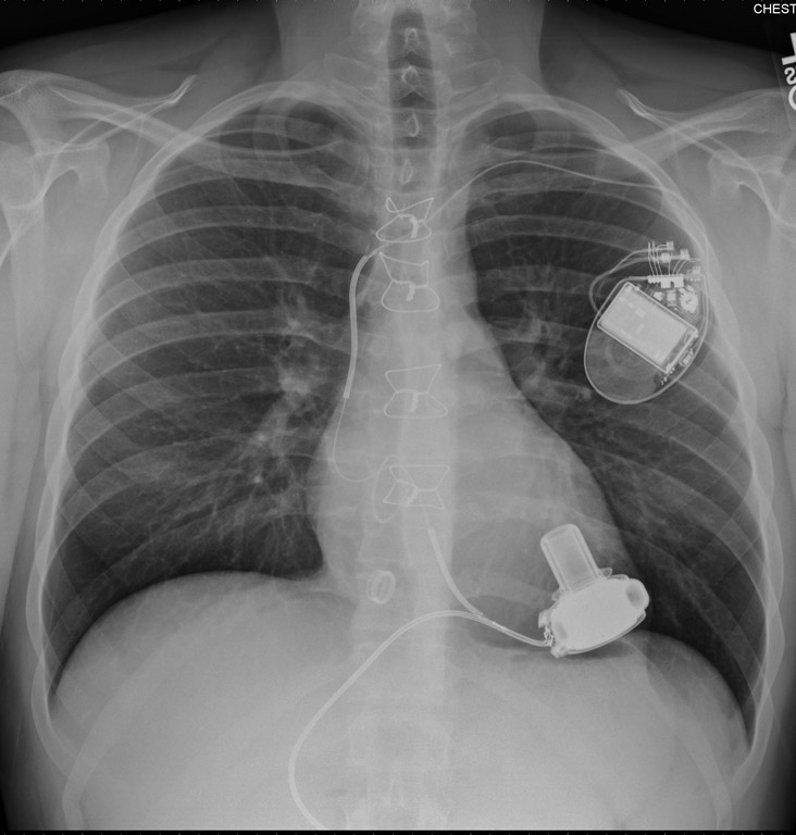 Pregnancy week 40 no contractions 511, could i be pregnant with heavy